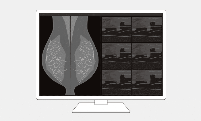 Para monitorów medycznych EIZO RadiForce GX570-MD (2 monitory)