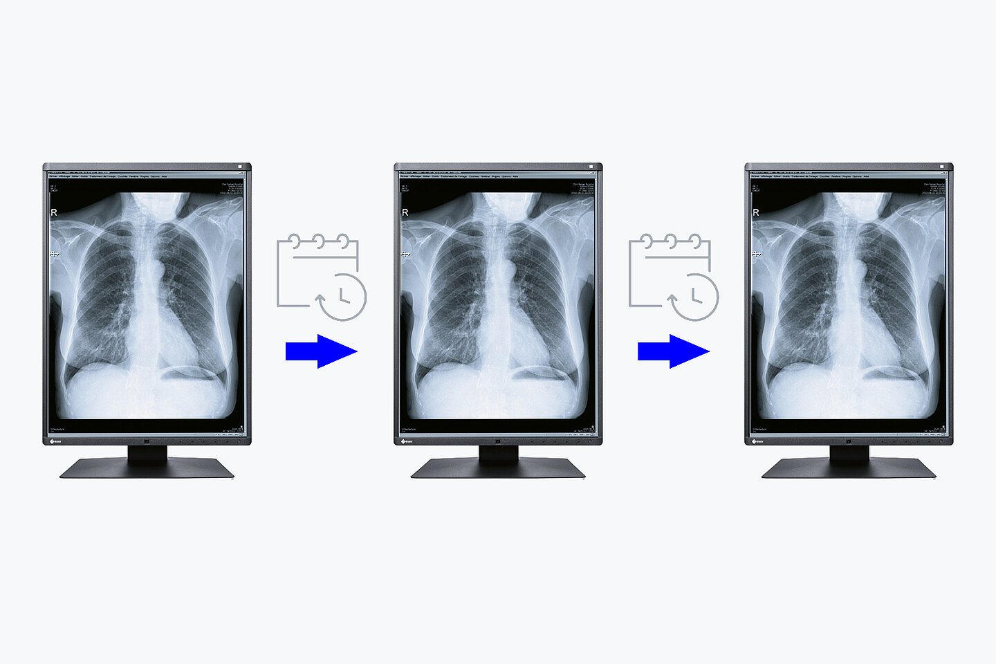 Para monitorów medycznych EIZO RadiForce GX570-MD (2 monitory)