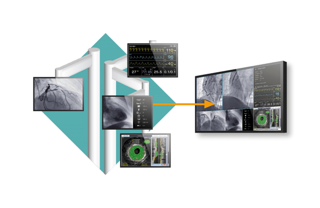  Monitor medyczny EIZO RadiForce LL580W