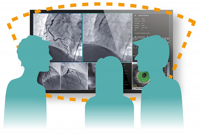 Monitor medyczny EIZO RadiForce LL580W