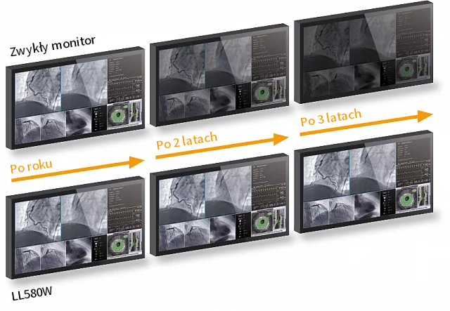 Monitor medyczny EIZO RadiForce LL580W