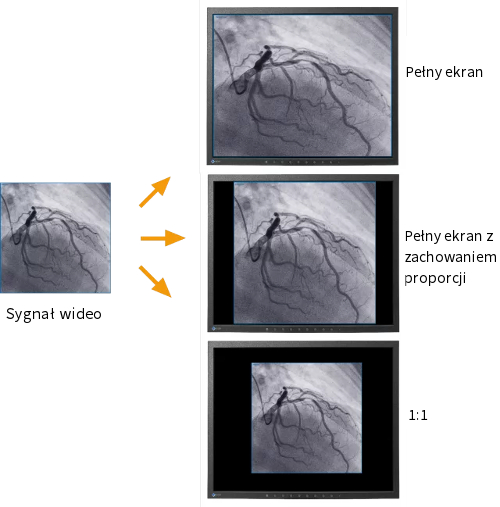 Monitor medyczny EIZO CuratOR LX1910