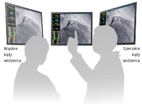 Monitor medyczny EIZO CuratOR LX1910