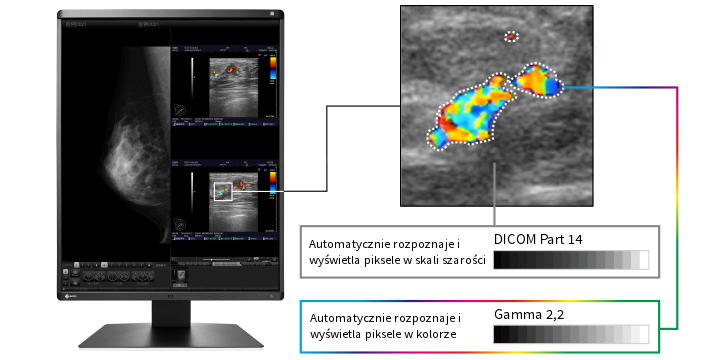 Monitor medyczny EIZO RadiForce RX370 