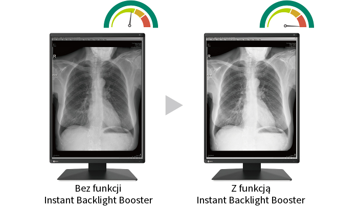 Monitor medyczny EIZO RadiForce RX370 