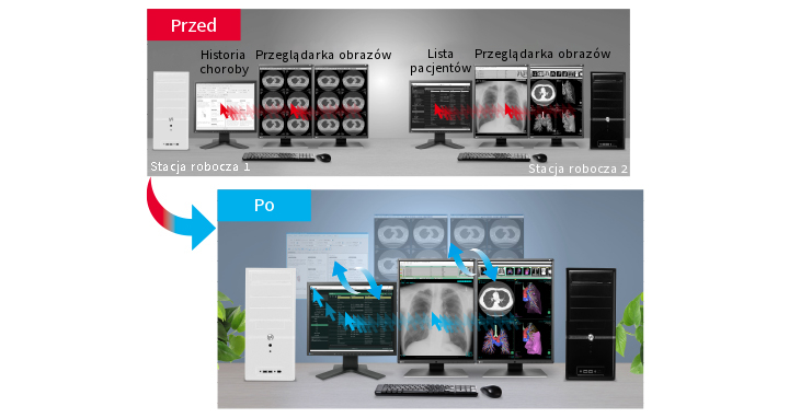 Monitor medyczny EIZO RadiForce RX370 
