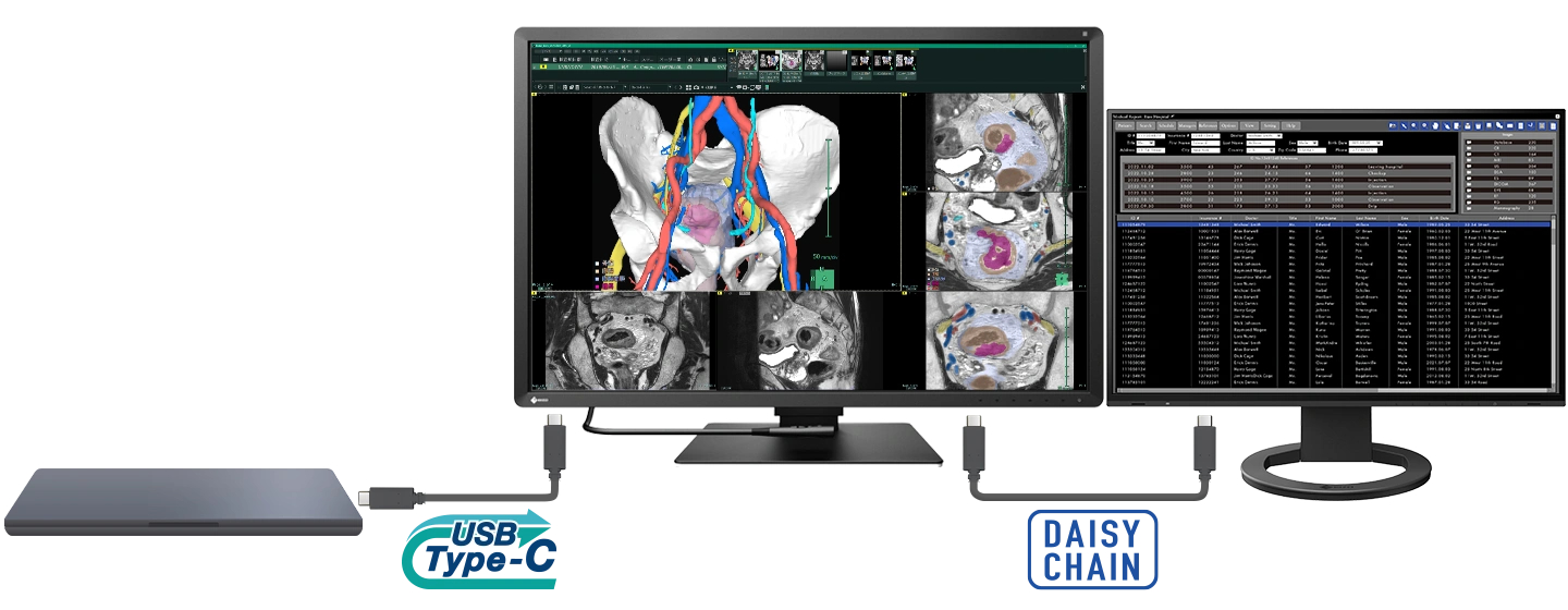Monitor medyczny EIZO RadiForce RX670