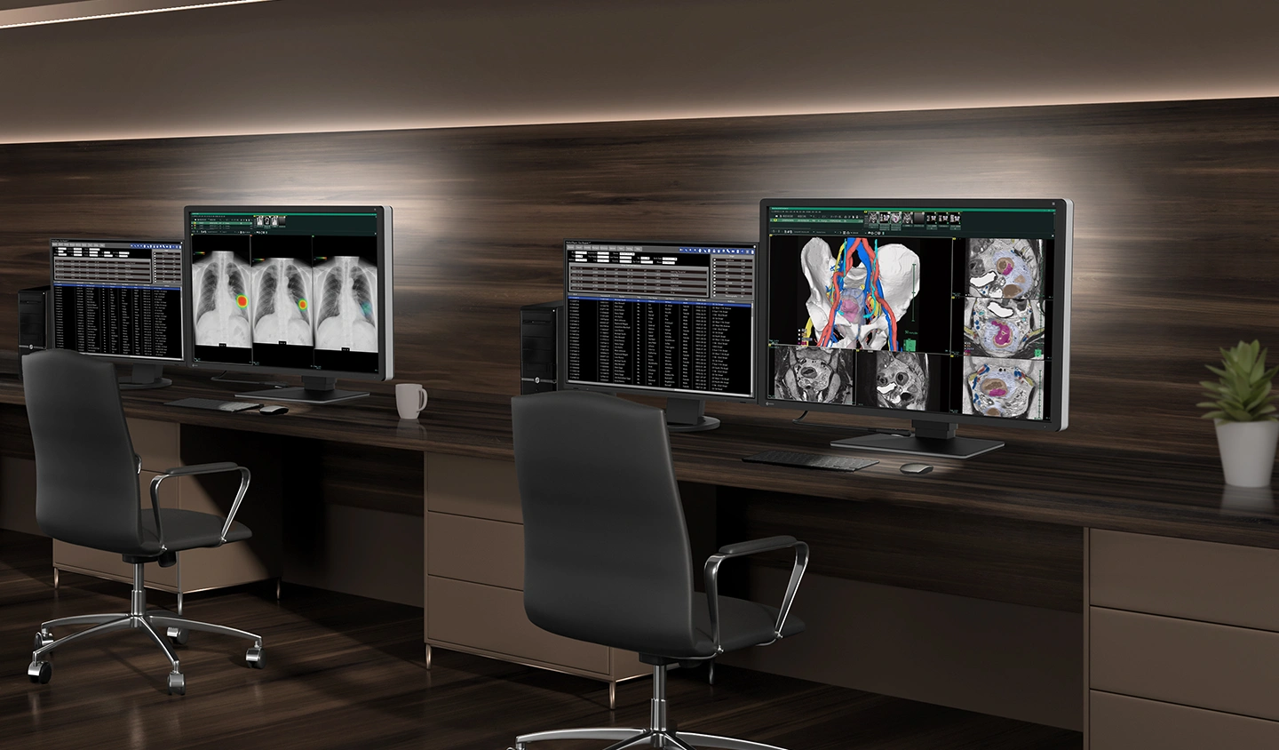 Monitor medyczny EIZO RadiForce RX670