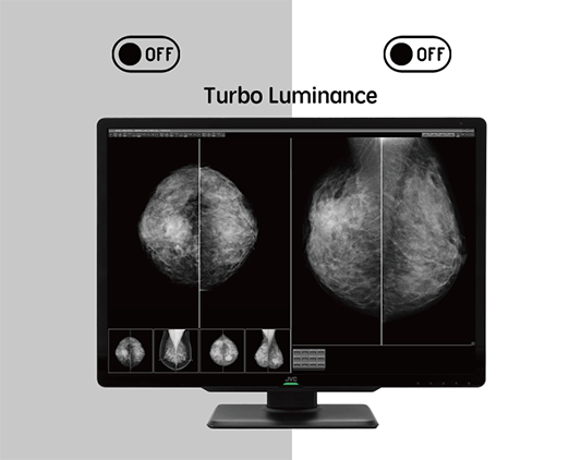 Monitor medyczny JVC CL-S1200