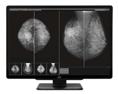 Monitor medyczny JVC CL-S1200