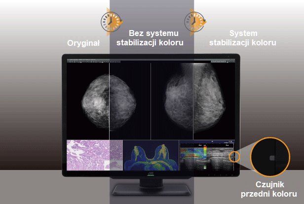 Monitor medyczny JVC CL-S1200