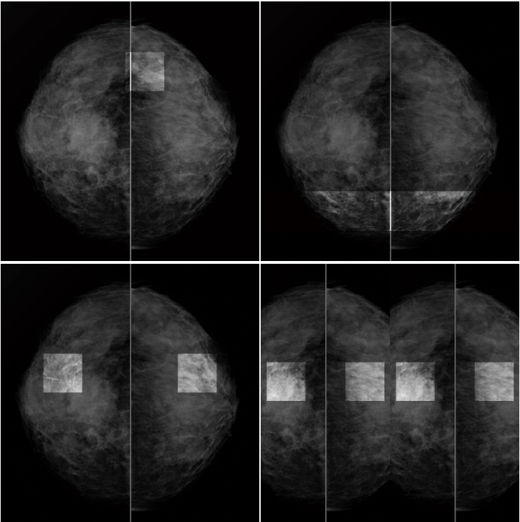 Monitor medyczny JVC CL-S1200