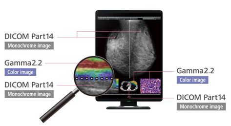 Monitor medyczny JVC CL-S500