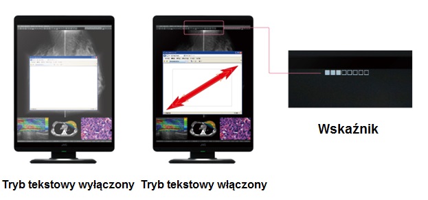 Monitor medyczny JVC CL-S500
