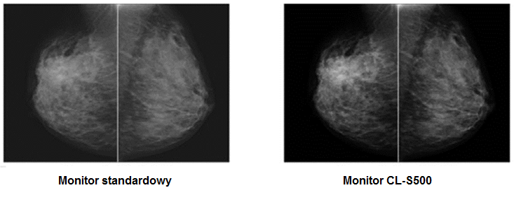 Monitor medyczny JVC CL-S500