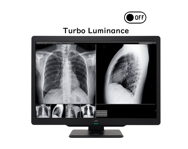 Monitor medyczny JVC CL-S600