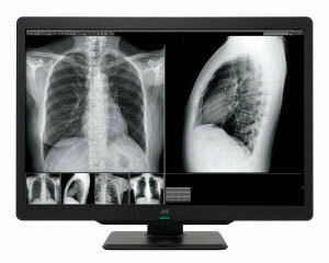 Monitor medyczny JVC CL-S600