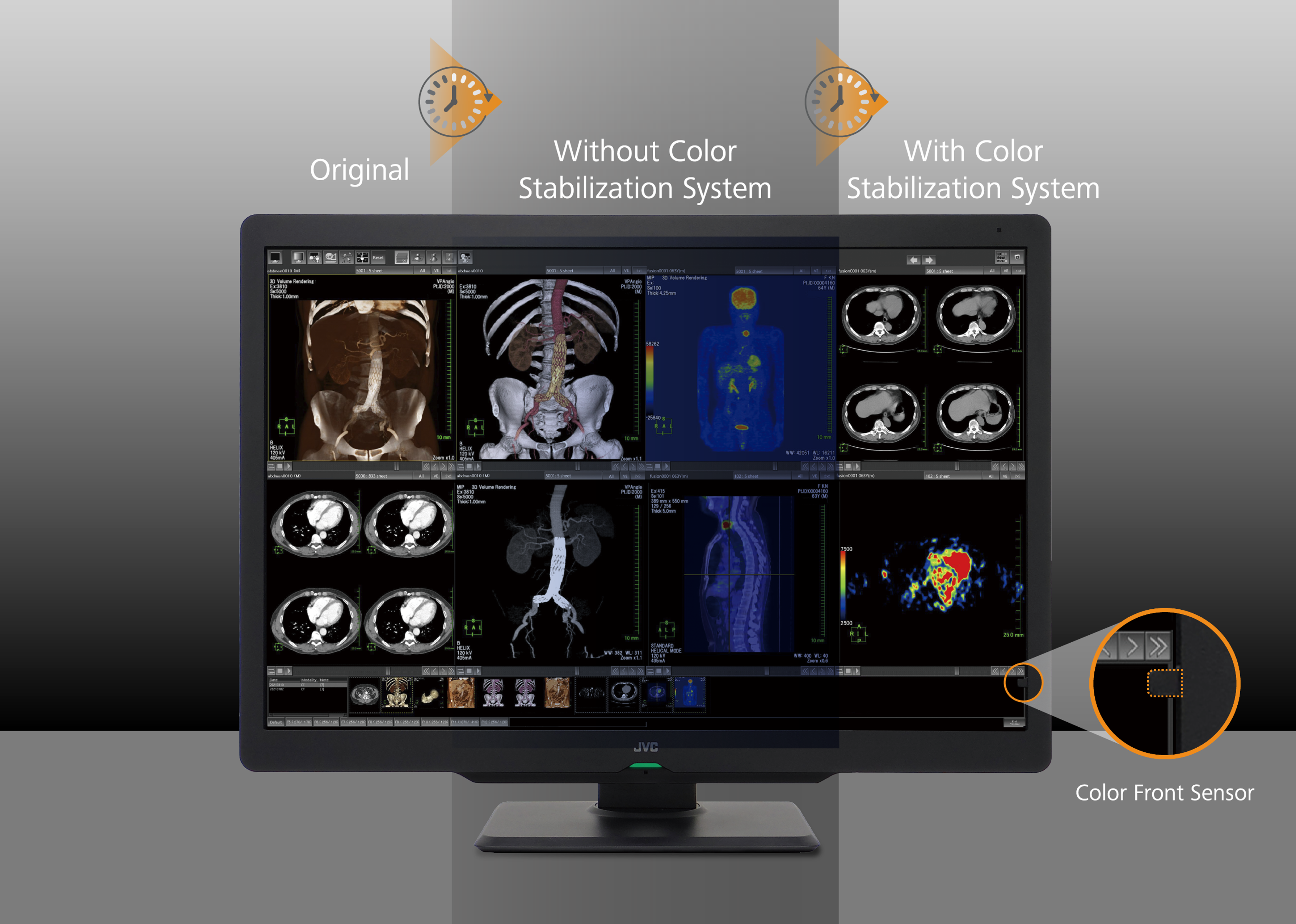 Monitor medyczny JVC CL-S600