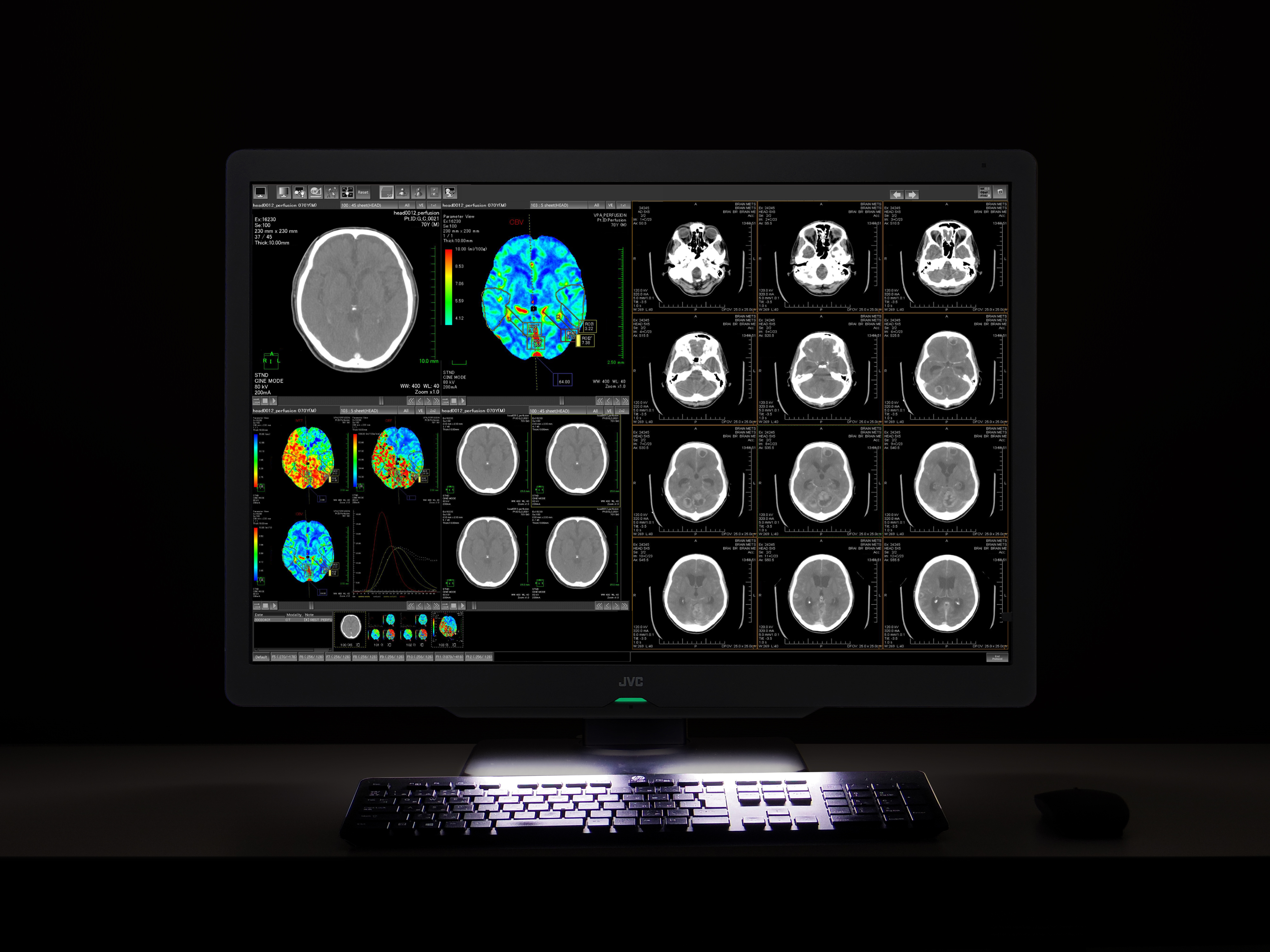 Monitor medyczny JVC CL-S600