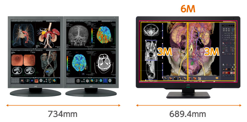 Monitor medyczny JVC CL-S600