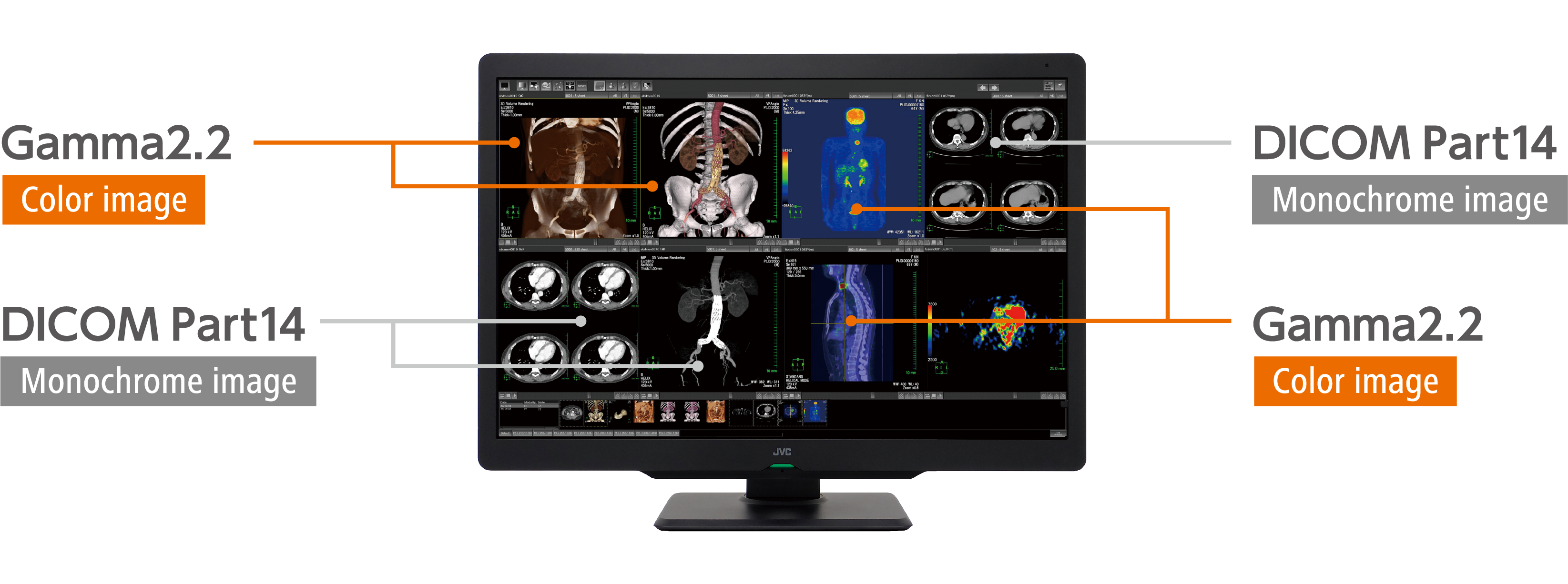 Monitor medyczny JVC CL-S600