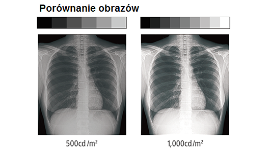 Monitor medyczny JVC MS-S300