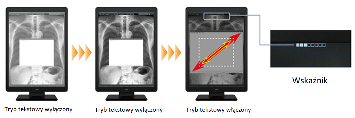 Monitor medyczny JVC MS-S300