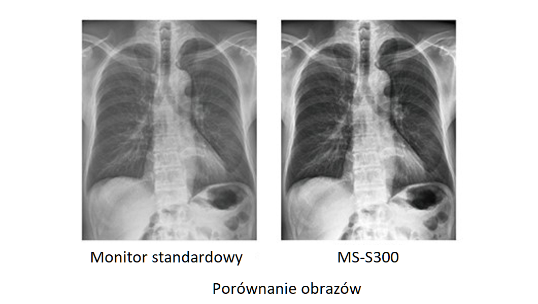 Monitor medyczny JVC MS-S300