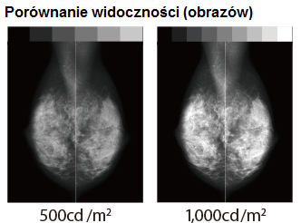 Monitor medyczny JVC MS-S500