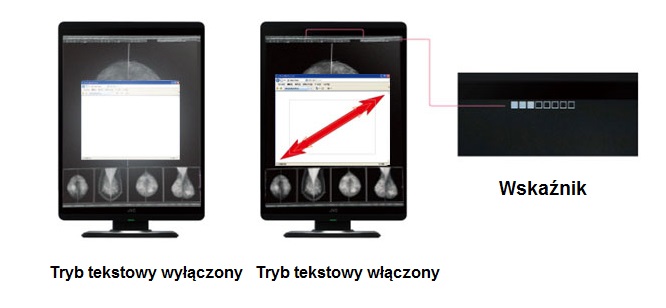 Monitor medyczny JVC MS-S500