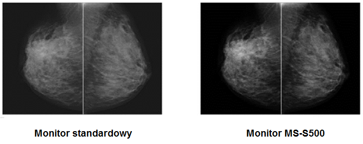 Monitor medyczny JVC MS-S500