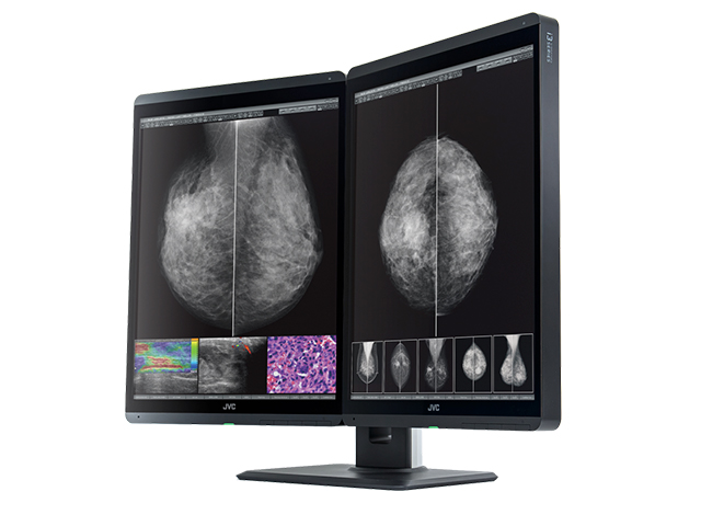 Monitor medyczny JVC MS-S500