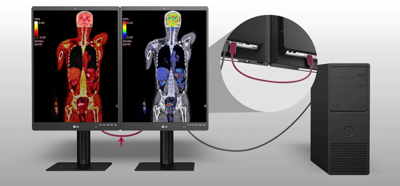 Monitor medyczny LG 21HQ513D-B