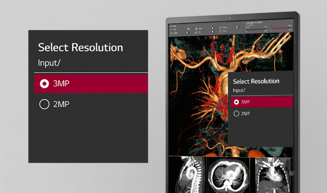 Monitor medyczny LG 21HQ513D-B