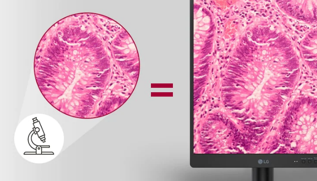 Monitor medyczny LG 21HQ513D-B