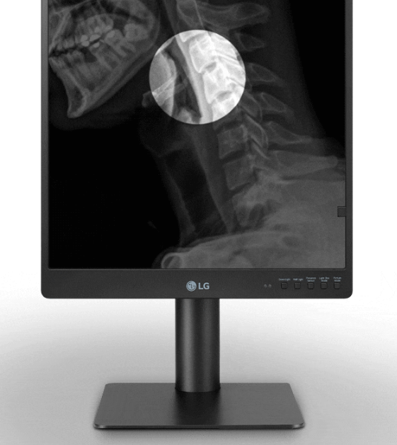 Monitor medyczny LG 21HQ513D-B