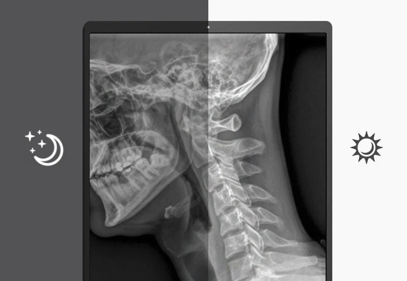 Monitor medyczny LG 21HQ513D-B