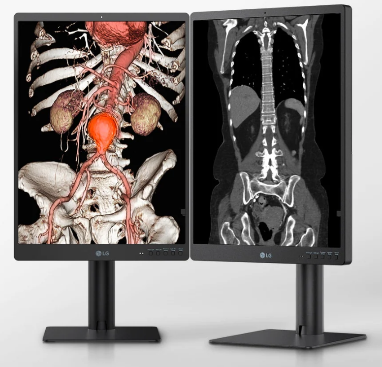 Monitor medyczny LG 21HQ513D-B