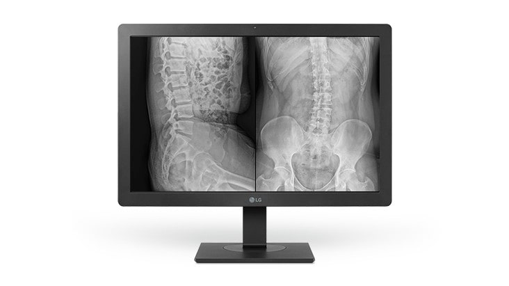 Monitor medyczny LG 24HR513C