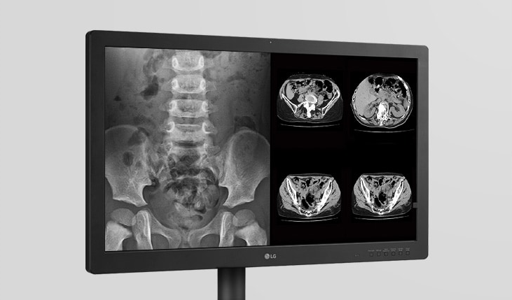 Monitor medyczny LG 32HQ713D