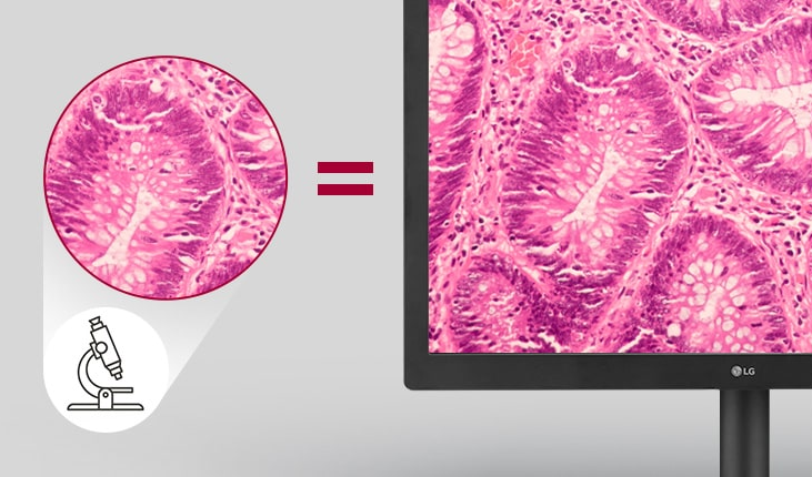 Monitor medyczny LG 24HR513C