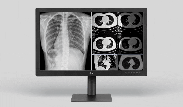 Monitor medyczny LG 32HQ713D