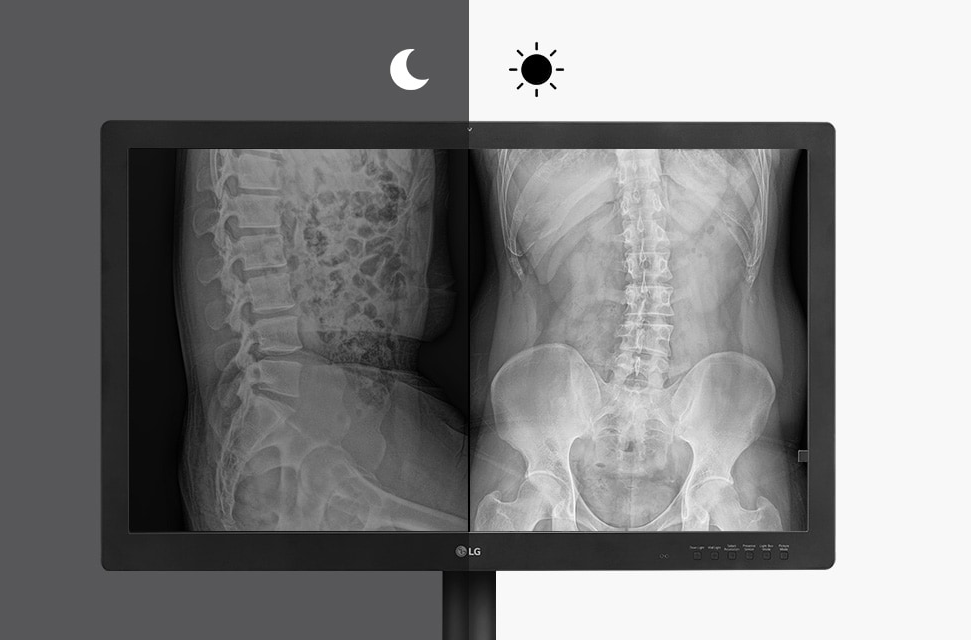 Monitor medyczny LG 32HQ713D